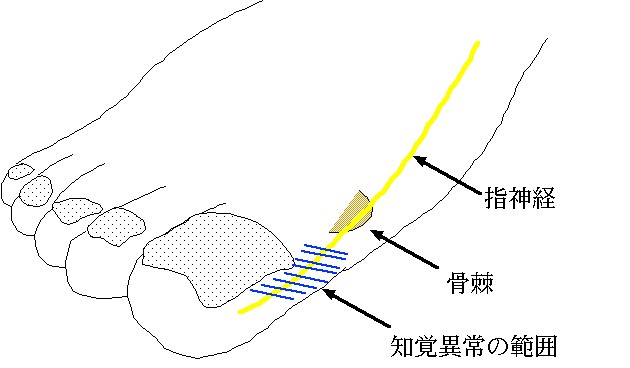 指神経の図