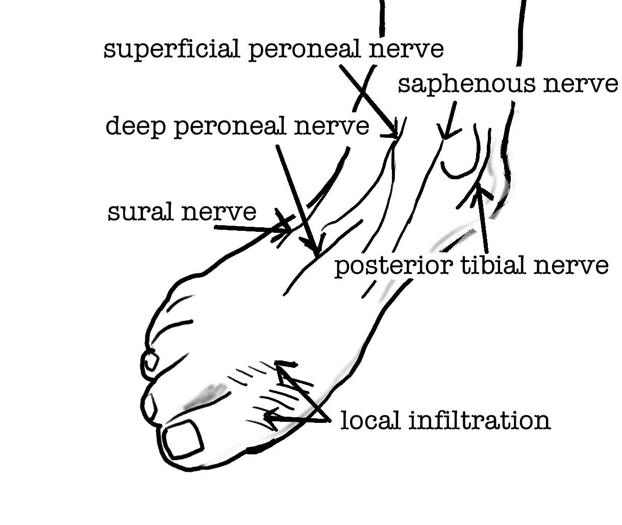 shcema_ankle_block.jpg