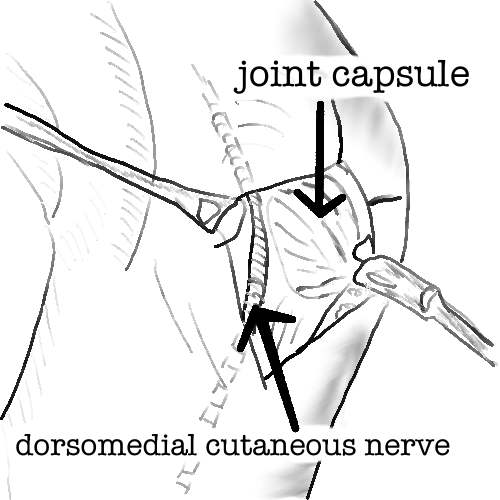 distal_skin_incision.jpg